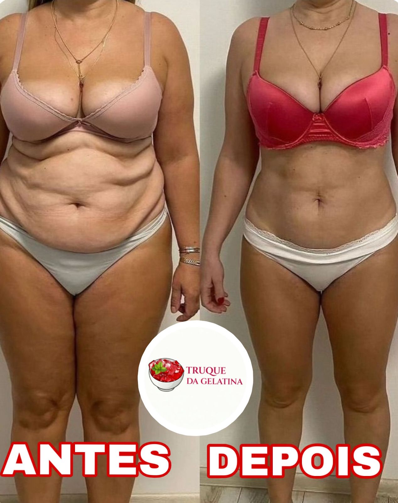 Antes e Depois Adriana